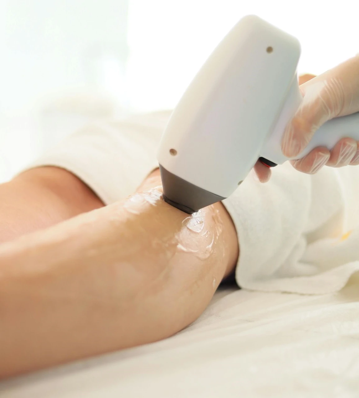 InnovaSkin, LASER pour une épilation durable, efficace et confortable.